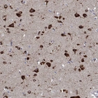 Immunohistochemical staining of human cerebral cortex shows high expression.