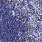 Immunohistochemical staining of human thymus shows nuclear positivity in a subset of cells.