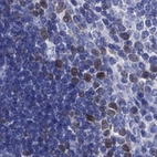 Immunohistochemical staining of human thymus shows nuclear positivity in a subset of cells.