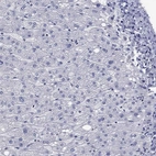 Immunohistochemical staining of human liver shows low expression as expected.