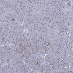 Immunohistochemical staining of human pancreas shows low expression as expected.