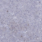 Immunohistochemical staining of human pancreas shows low expression as expected.