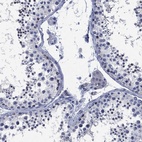 Immunohistochemical staining of human testis shows low expression as expected.