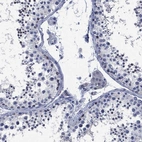 Immunohistochemical staining of human testis shows low expression as expected.