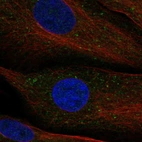 Anti-APPL2 Antibody