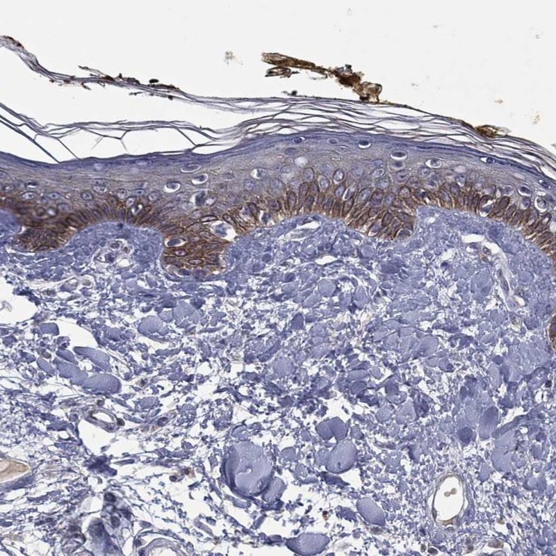 Anti-DSG4 Antibody