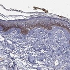 Anti-DSG4 Antibody