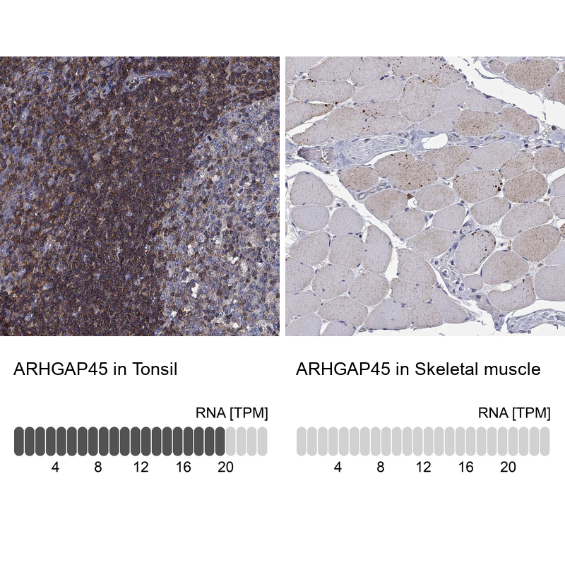 Anti-ARHGAP45 Antibody