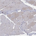 Immunohistochemical staining of human skeletal muscle shows low expression as expected.
