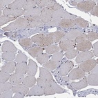 Anti-ARHGAP45 Antibody