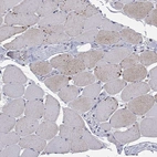 Immunohistochemical staining of human skeletal muscle shows low expression as expected.