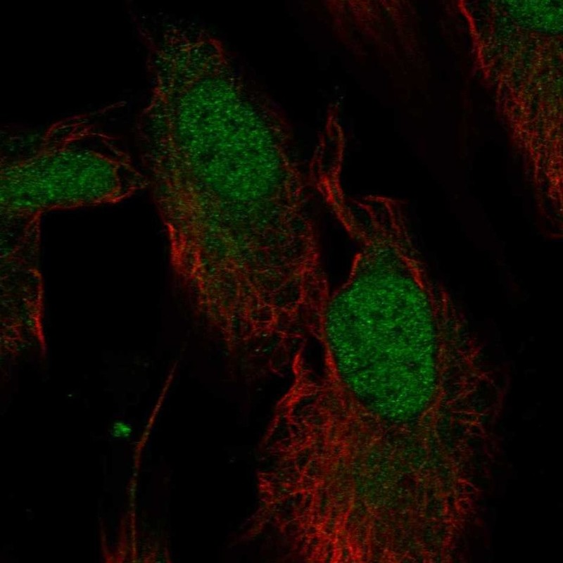 Anti-NT5DC1 Antibody
