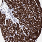 Immunohistochemical staining of human heart muscle shows high expression.