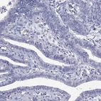 Immunohistochemical staining of human fallopian tube shows low expression as expected.