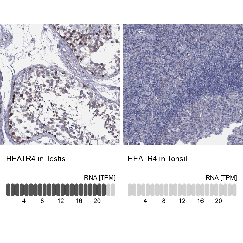 Anti-HEATR4 Antibody