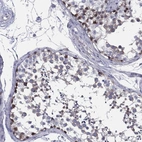 Immunohistochemical staining of human testis shows high expression.