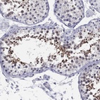 Immunohistochemical staining of human testis shows high expression.