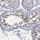 Immunohistochemical staining of human testis shows high expression.