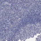 Immunohistochemical staining of human tonsil shows low expression as expected.