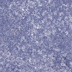 Immunohistochemical staining of human lymph node shows low expression as expected.