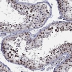 Anti-DGCR8 Antibody