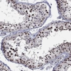 Anti-DGCR8 Antibody