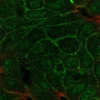 Anti-TMEM52 Antibody
