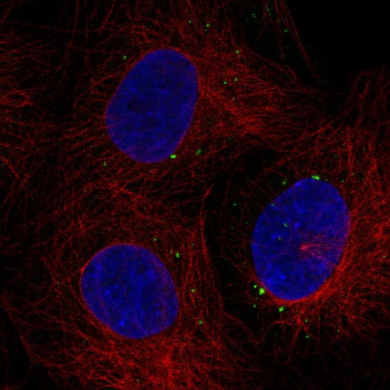 Anti-C1orf105 Antibody
