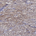 Anti-HSPB2 Antibody
