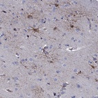 Immunohistochemical staining of human cerebral cortex shows high expression.
