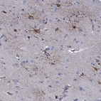 Immunohistochemical staining of human cerebral cortex shows high expression.