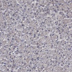 Immunohistochemical staining of human liver shows low expression as expected.