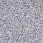 Immunohistochemical staining of human liver shows low expression as expected.