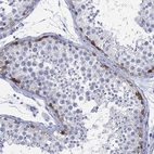 Immunohistochemical staining of human testis shows high expression.