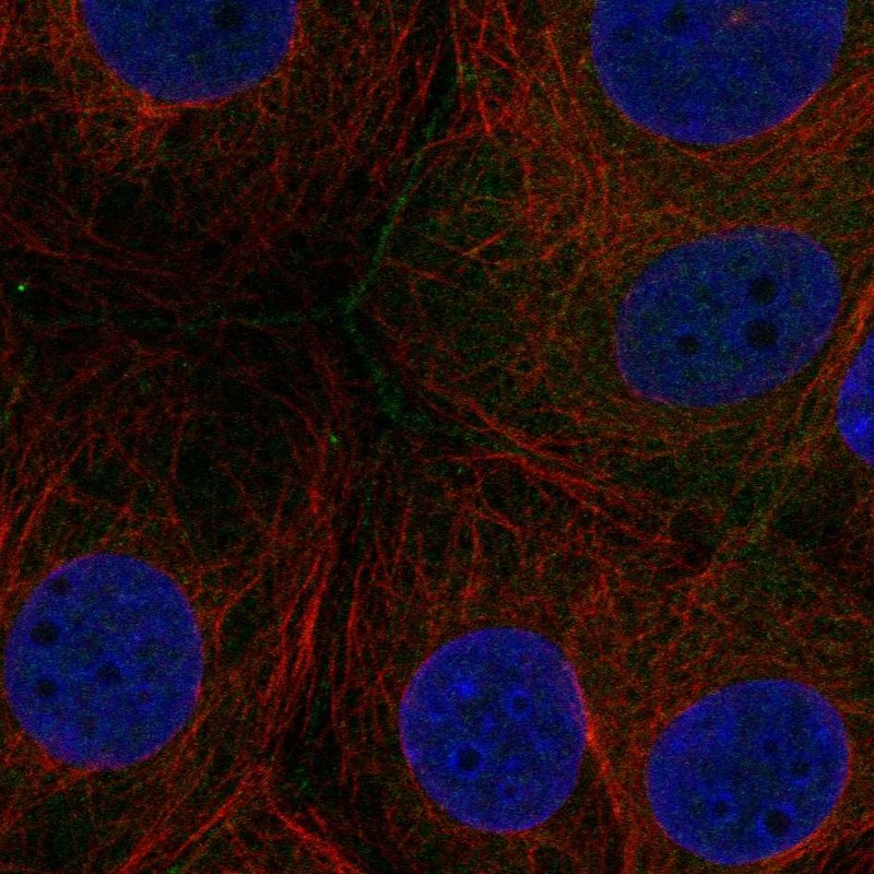Anti-FAM209A Antibody