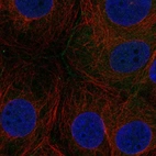 Anti-FAM209A Antibody