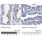 Anti-ADAD2 Antibody