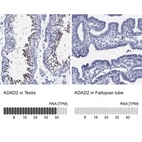 Anti-ADAD2 Antibody