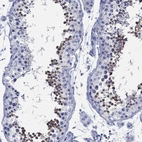 Immunohistochemical staining of human testis shows high expression.