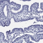 Immunohistochemical staining of human fallopian tube shows low expression as expected.