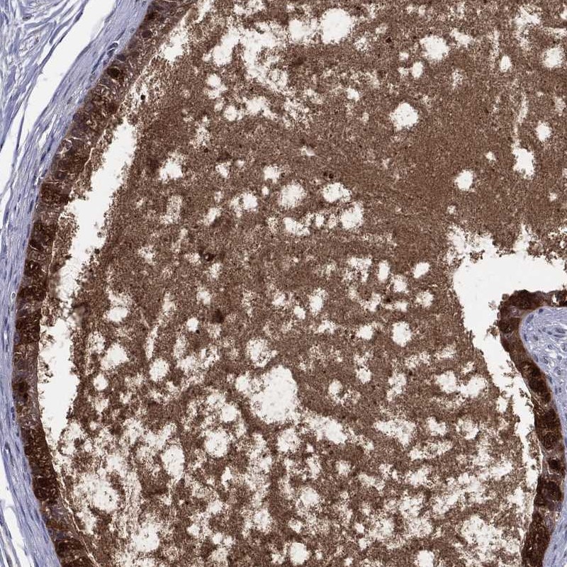 Anti-DEFB121 Antibody