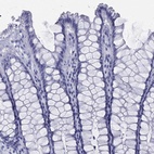 Immunohistochemical staining of human rectum shows low expression as expected.