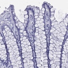 Anti-TMEM252 Antibody