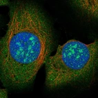 Anti-RAD51AP2 Antibody