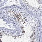 Anti-TMEM247 Antibody