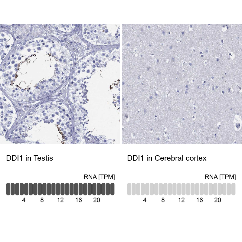 Anti-DDI1 Antibody