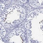 Immunohistochemical staining of human testis shows high expression.