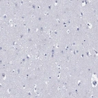 Immunohistochemical staining of human cerebral cortex shows low expression as expected.