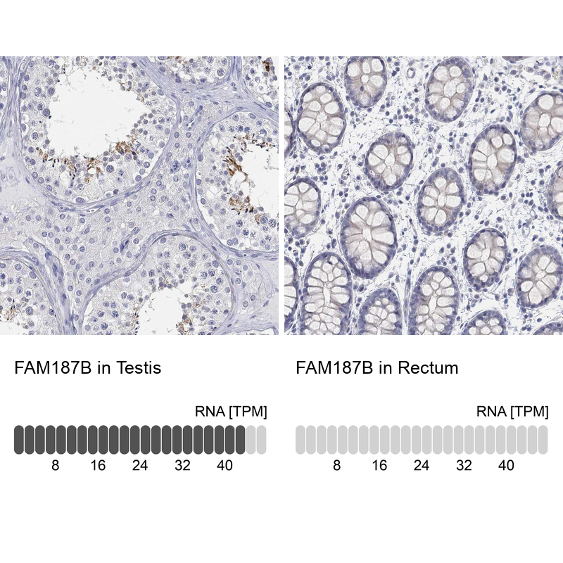 Anti-FAM187B Antibody