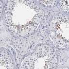 Immunohistochemical staining of human testis shows high expression.